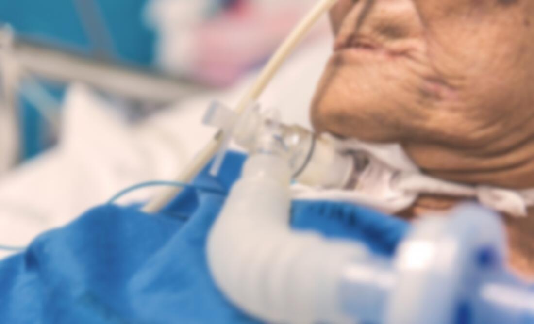 best care for tracheostomy patients